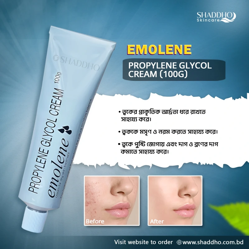 Emolene Propylene Glycol Cream (100g)