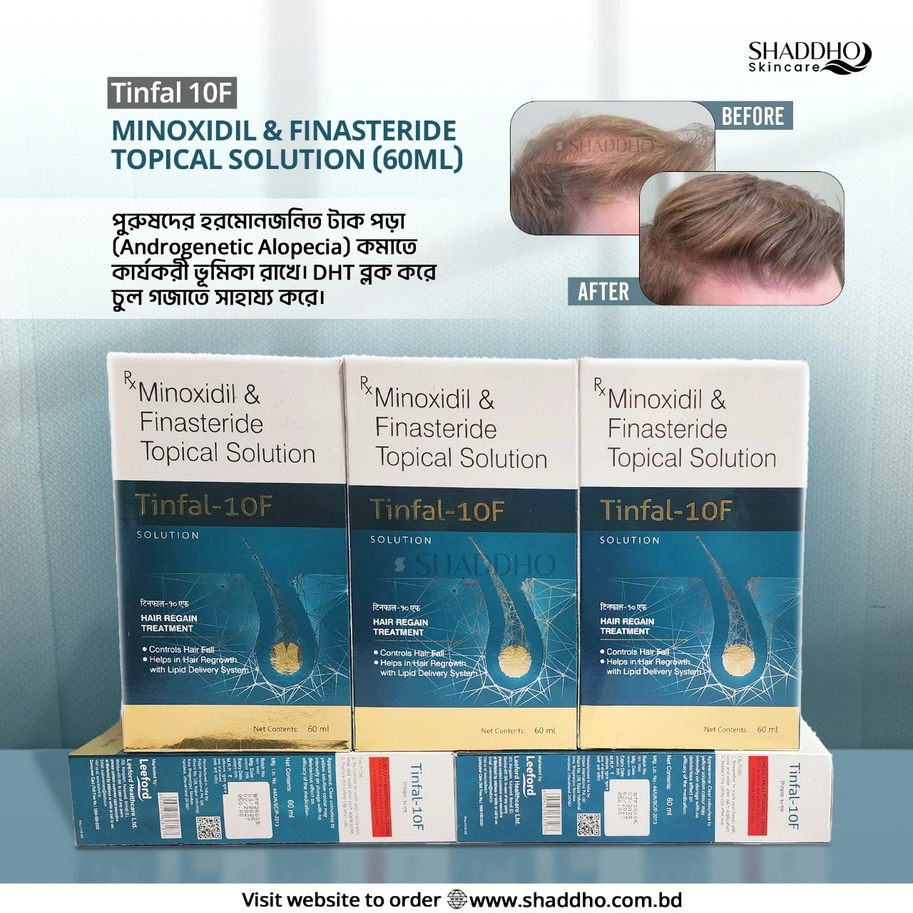 Tinfal 10F Minoxidil & Finasteride Topical Solution (60ml)