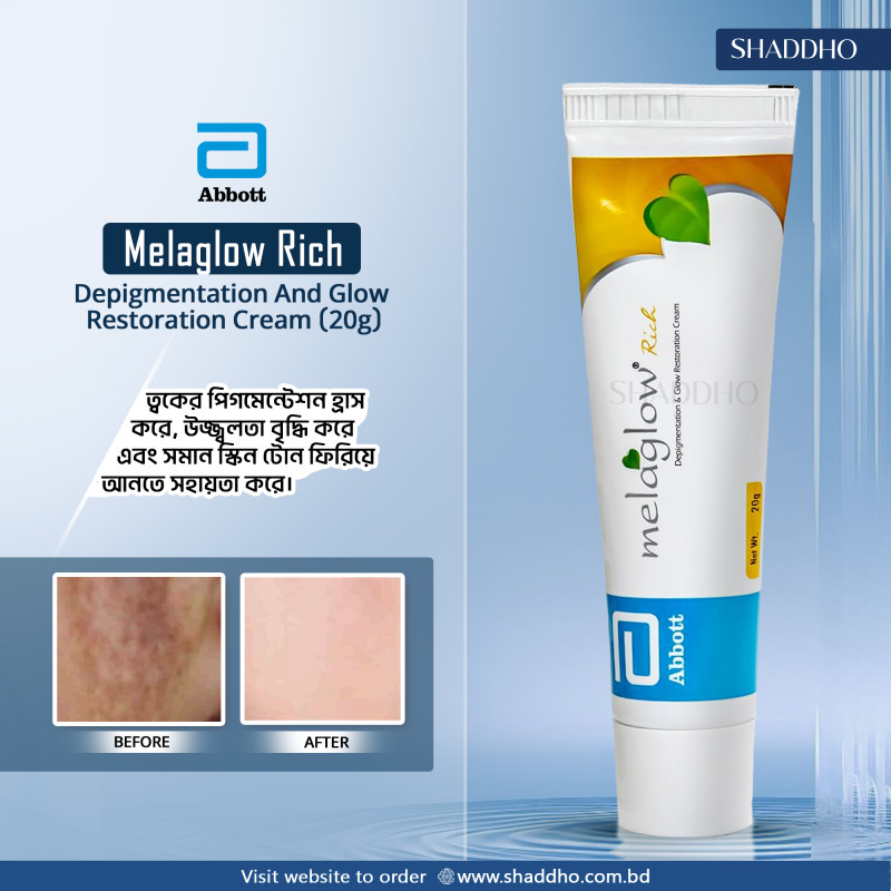 Abbott Melaglow Rich Depigmentation And Glow Restoration Cream (20g)